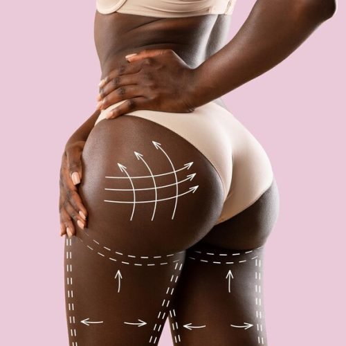 Top-Clinics-for-Brazilian-Butt-Lift-in-Turkey Top-Clinics-for-Brazilian-Butt-Lift-in-Turkey